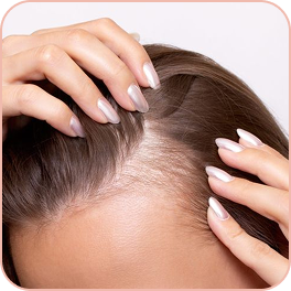 MORE VISIBLE SCALP